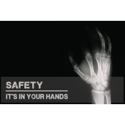 Hand Safety - X-RAY